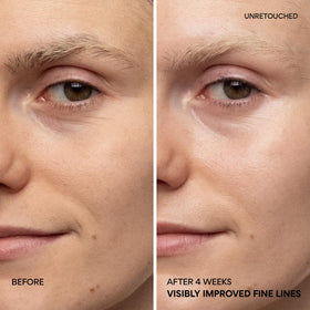 innisfree application around eye area showing gentle patting, reduces fine lines