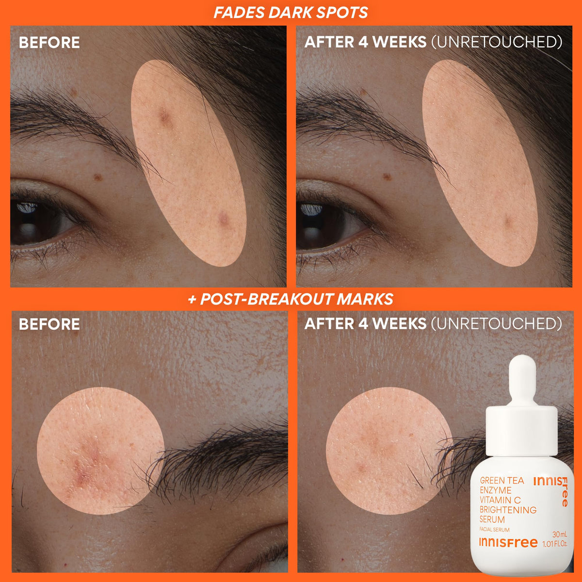 applying innisfree serum to cheek demonstrating usage and improved skin radiance