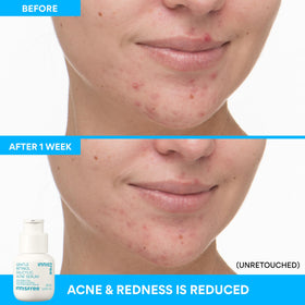 innisfree applied on hand to show absorption and non-greasy finish