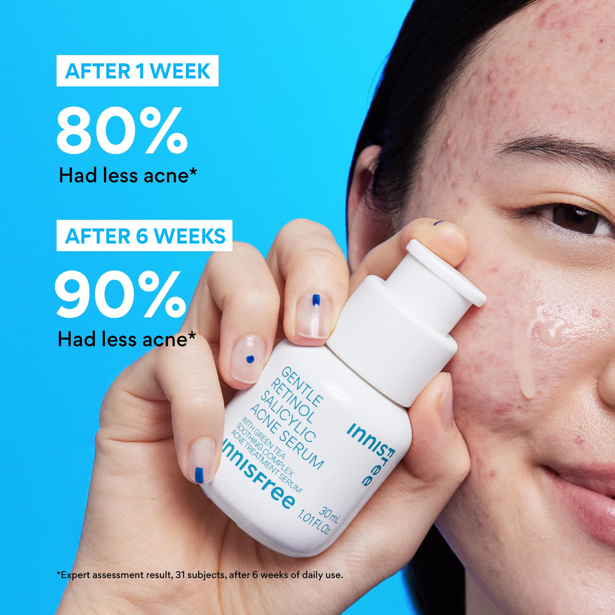 innisfree ingredient label highlighting salicylic acid and green tea complex benefits