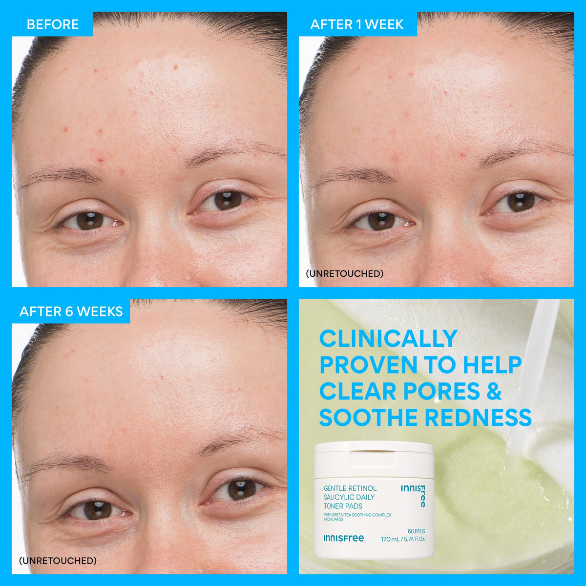 innisfree pad in hand showing scale and easy daily use benefit