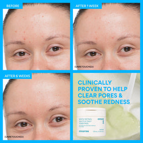 innisfree pad in hand showing scale and easy daily use benefit