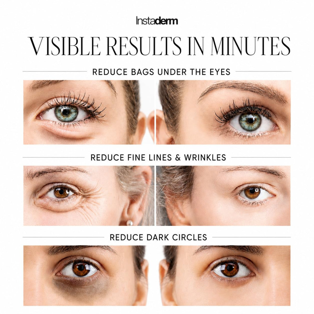 Instaderm application under eye tapping technique for quick tightening