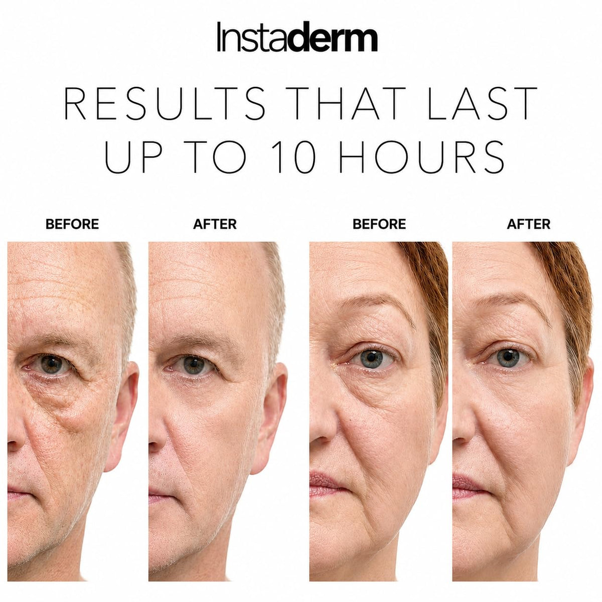 Instaderm before and after comparison showing reduced puffiness
