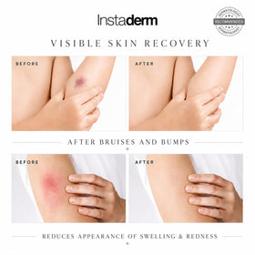 Instaderm on face and body illustrating versatile use and hydration