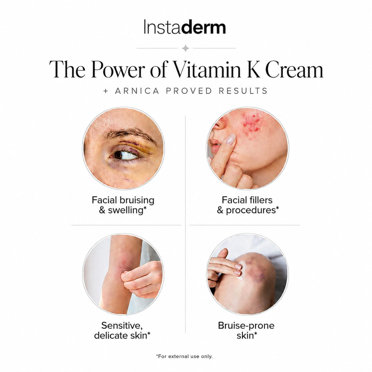 Instaderm and arnica close-up highlighting botanical soothing benefit