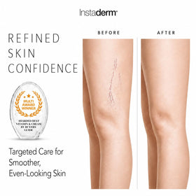 Instaderm held in hand to show actual size and easy portability