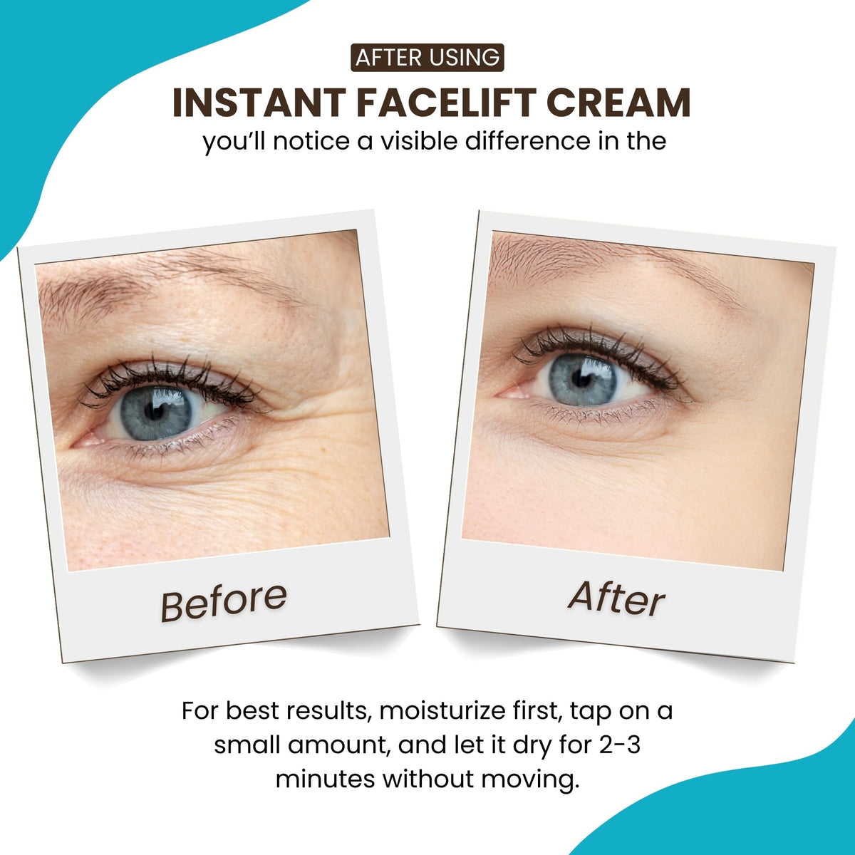Instantly Ageless application under-eye demonstrating targeted puffiness reduction