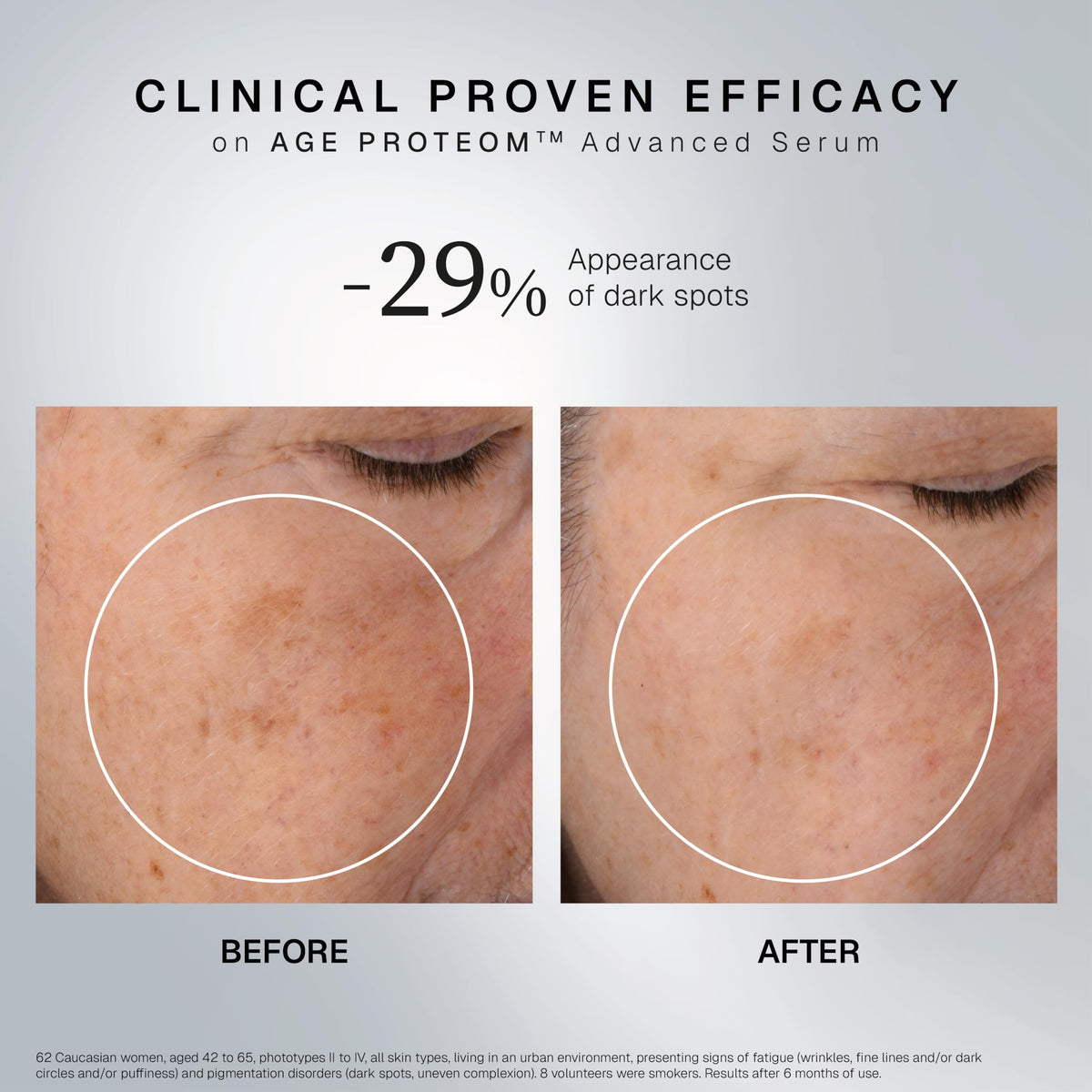 INSTITUT ESTHEDERM PARIS applying serum to neck demonstrating firming benefit