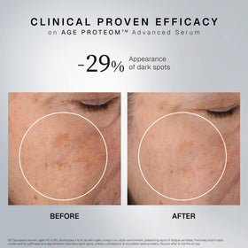 INSTITUT ESTHEDERM PARIS applying serum to neck demonstrating firming benefit