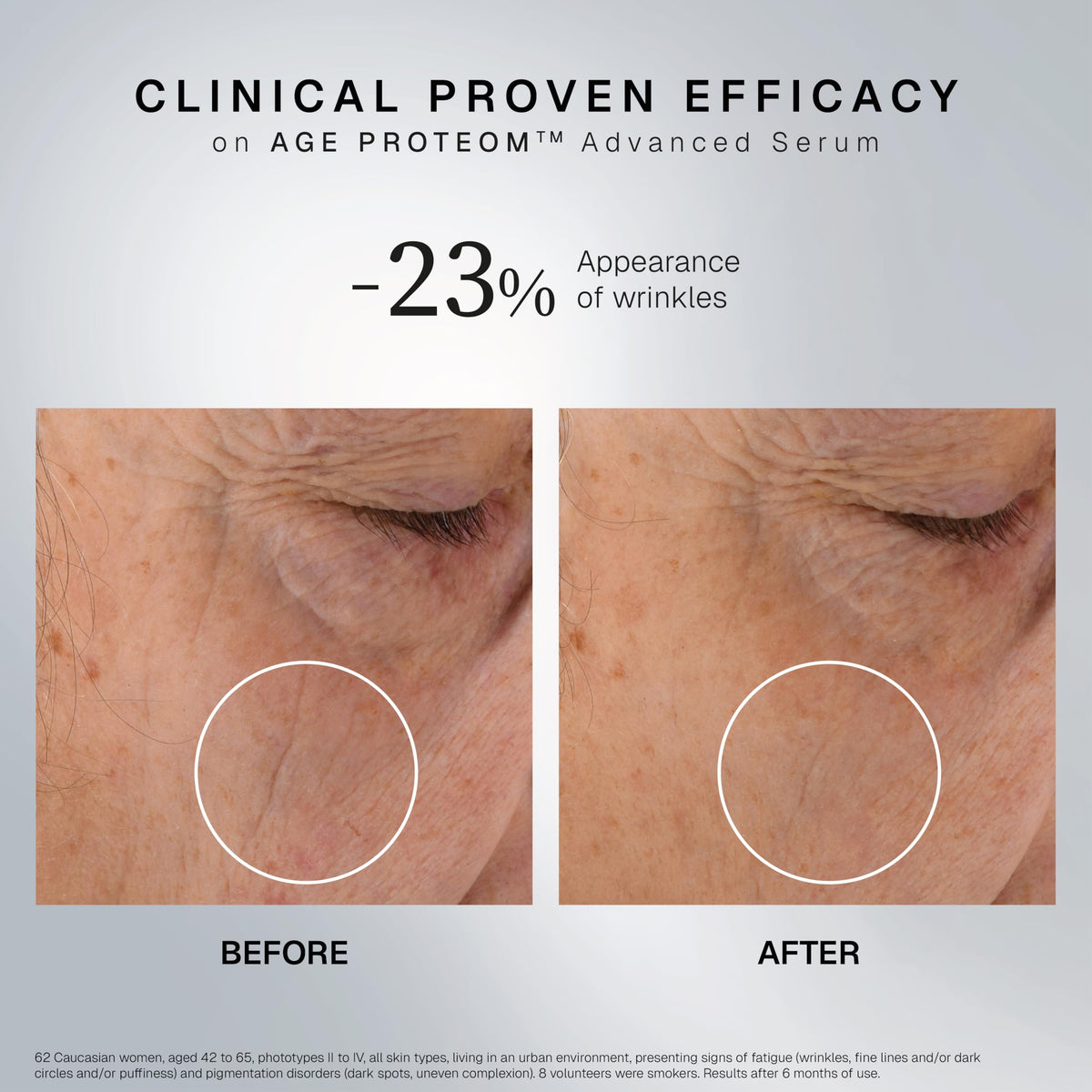 INSTITUT ESTHEDERM PARIS pipette dispensing five drops for precise dosing benefit
