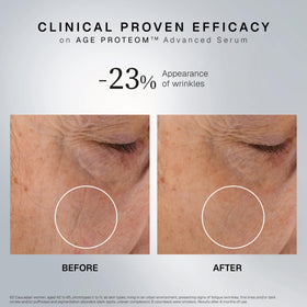 INSTITUT ESTHEDERM PARIS pipette dispensing five drops for precise dosing benefit