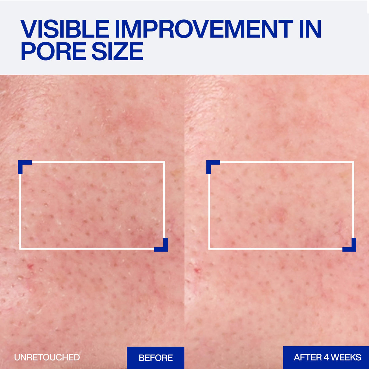 IOPE ingredient label close-up showing retinol complex for clarity