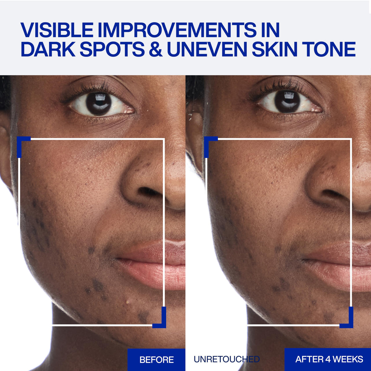 IOPE cream texture close-up showing weightless finish and melt-in hydration benefit