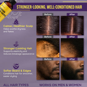 IQNATURAL scalp massage application demonstrating targeted scalp care