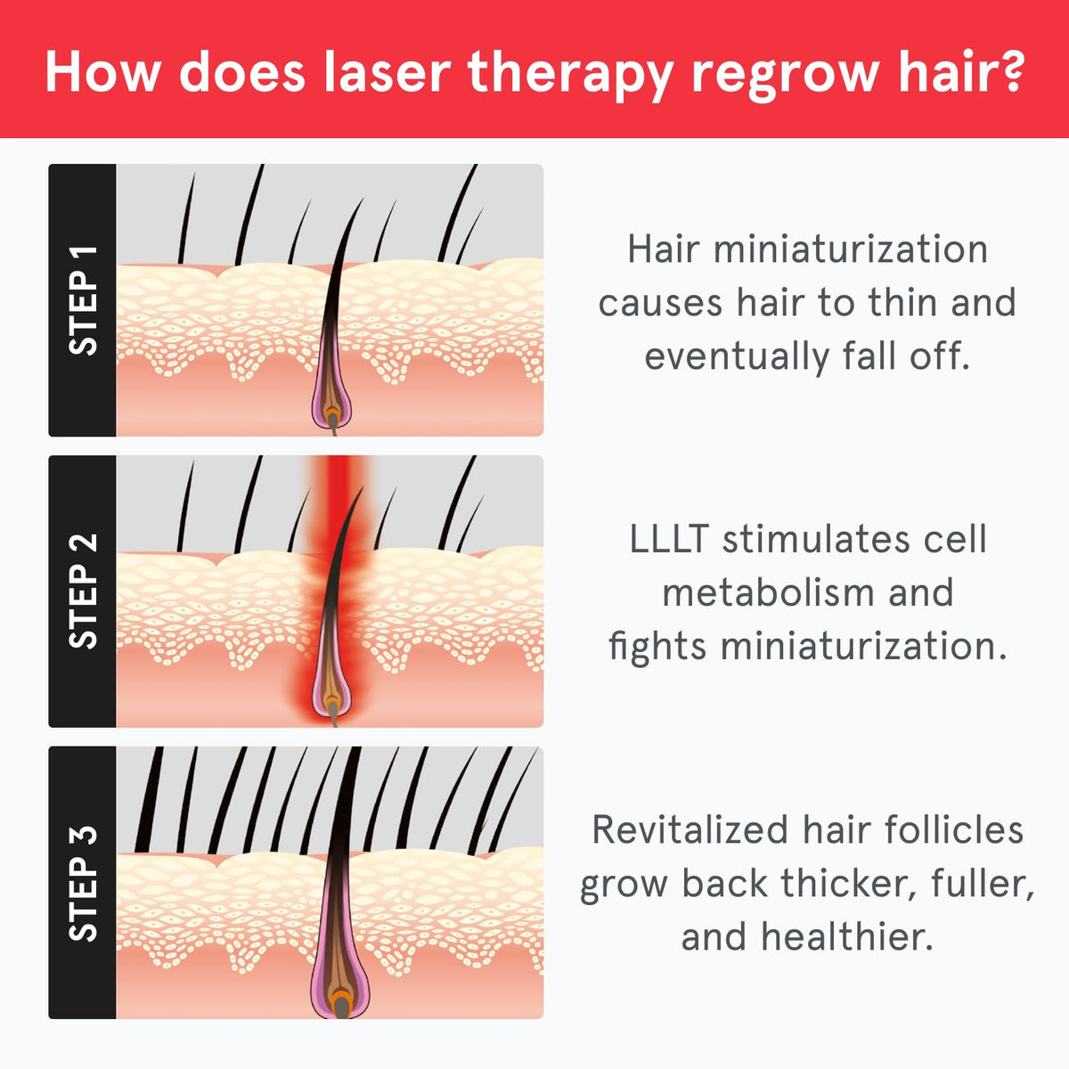 iRestore illustrative before and after concept showing fuller-looking hair benefit