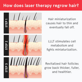 iRestore illustrative before and after concept showing fuller-looking hair benefit