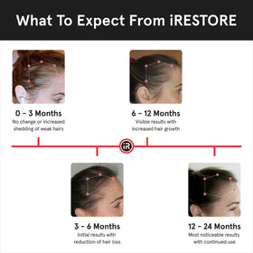 iRestore styled hair before and after example showing improved hair density benefit