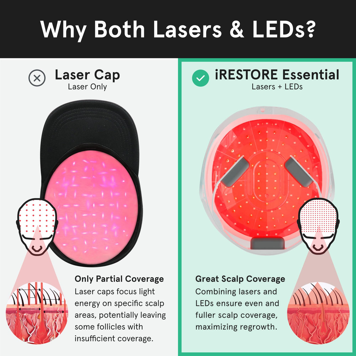 iRestore packaging and manual showing what’s included for easy setup benefit