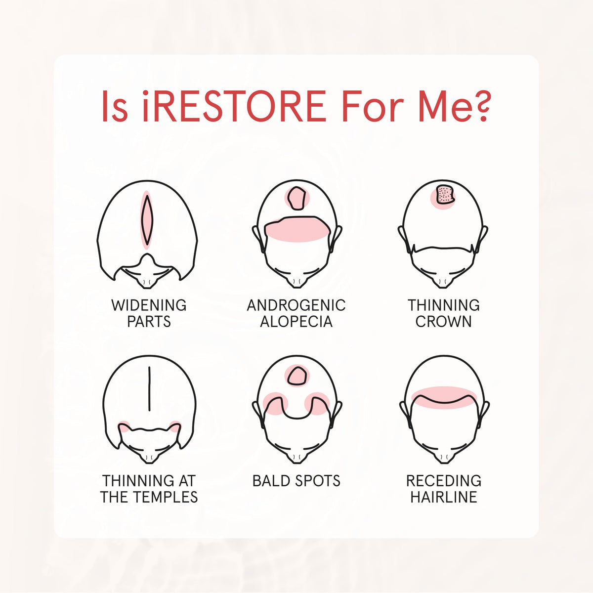 iRestore shampoo being massaged into hair demonstrating scalp nourishment