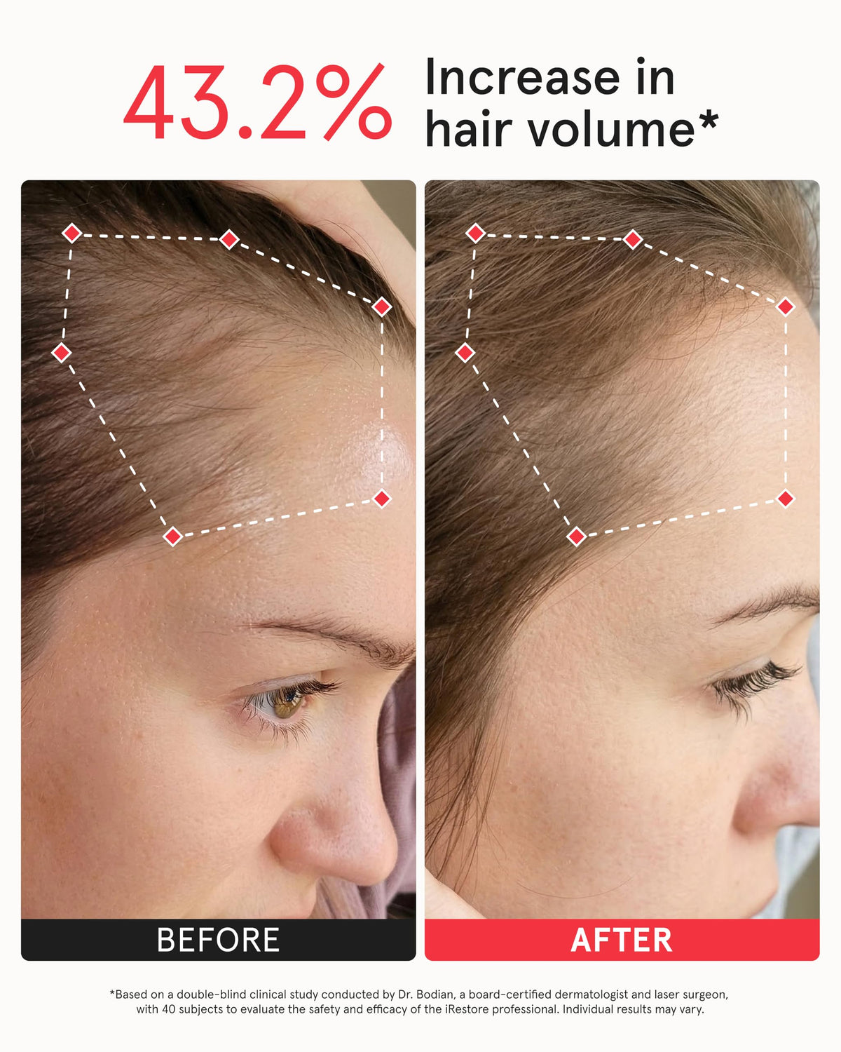 Person wearing iRestore Pro in living room enjoying hands-free treatment benefit