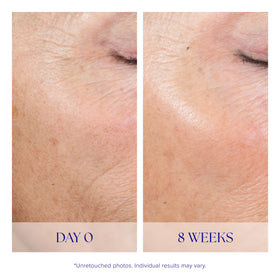 iS CLINICAL product being applied to skin demonstrating simple at-home use