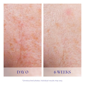 iS CLINICAL applying serum to cheek showing smooth finish benefit
