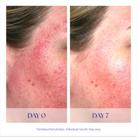 iS CLINICAL label close-up featuring key ingredients for antioxidant and reparative support