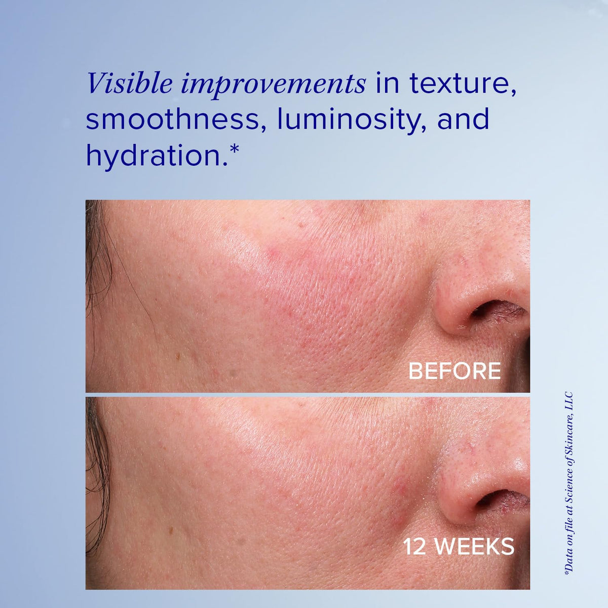 iS CLINICAL emulsion applied to hand, demonstrates non-greasy absorption benefit