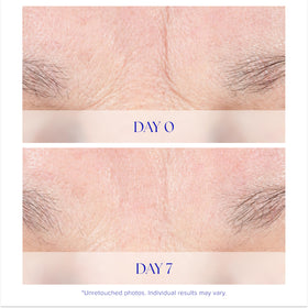 iS CLINICAL ingredient close-up illustrating renewing actives for smoother skin