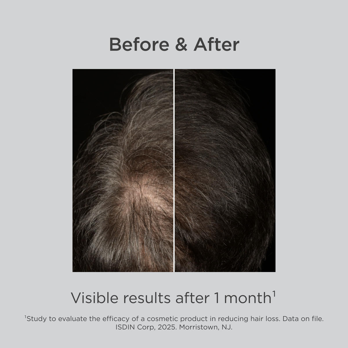 ISDIN ingredient visual of Diaminopyrimidine oxide supporting hair nutrition