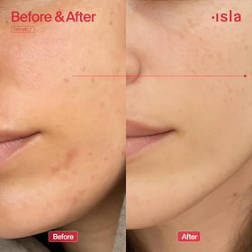 ISLA Olive Fruit Oil droplet close-up, communicates antioxidant moisturizing benefits