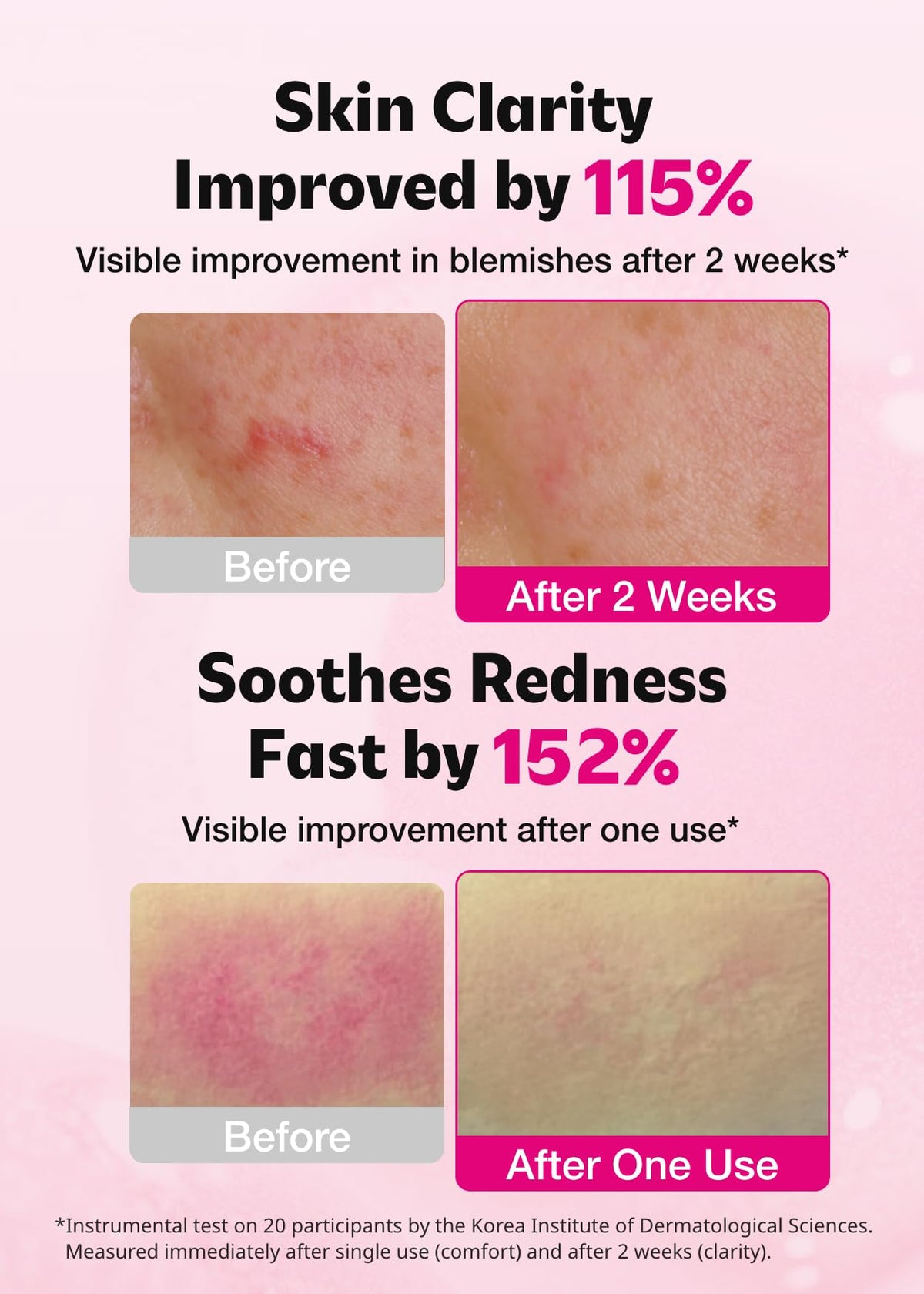 ISOI close-up texture of serum highlighting lightweight, fast-absorbing finish