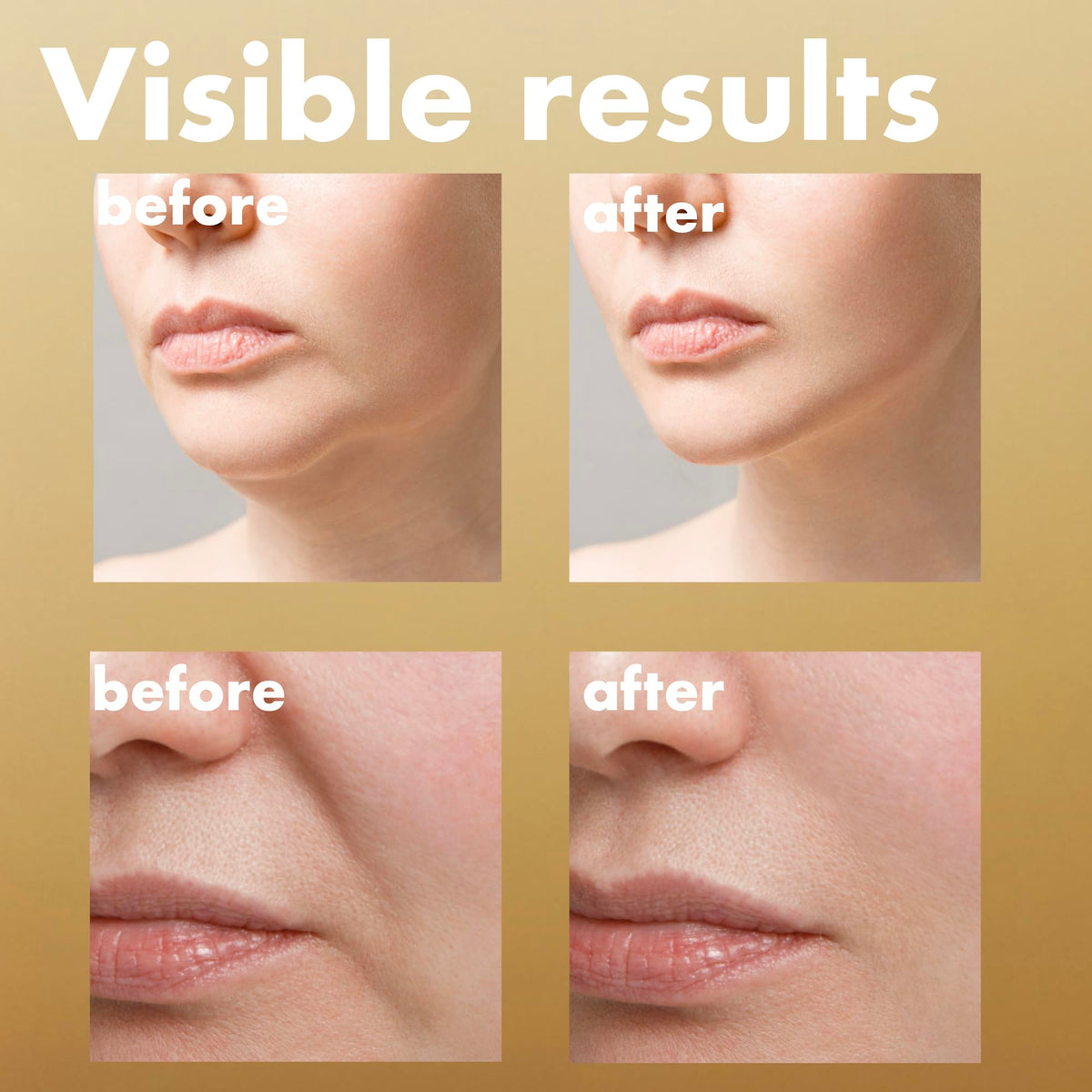 ISOI Bulgarian rose oil closeup showing nourishing botanical benefit