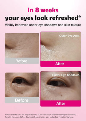 ISOI patch applied under eye in morning routine to reduce puffiness and awaken skin