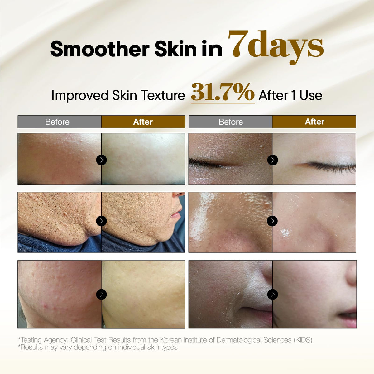 it:fu Soonyuul open jar top view showing creamy non-greasy consistency