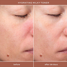 ITK applying serum on hand demonstrating lightweight absorption