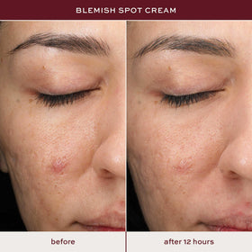 ITK product in bathroom setting for convenient daily skincare routine