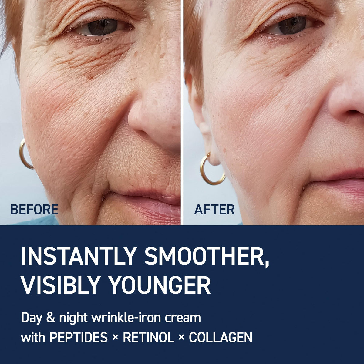 IVOSKIN cream being applied to neck, demonstrates targeted firming care