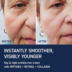 IVOSKIN cream being applied to neck, demonstrates targeted firming care