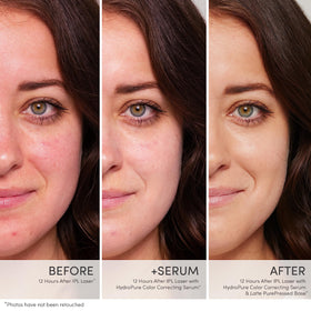 jane iredale applying serum to face to show calming and smoothing benefit