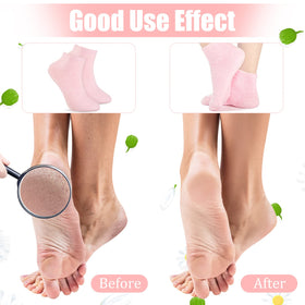 Janmercy socks worn overnight on bed supporting deeper foot hydration