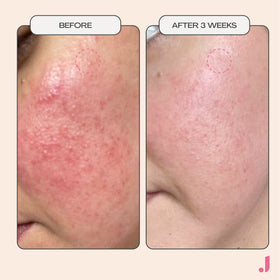 JESS BEAUTY gel spread across skin showing smooth, non-greasy finish