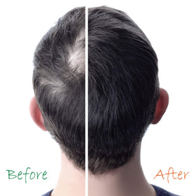 jf labs applying booster to scalp for targeted thinning support