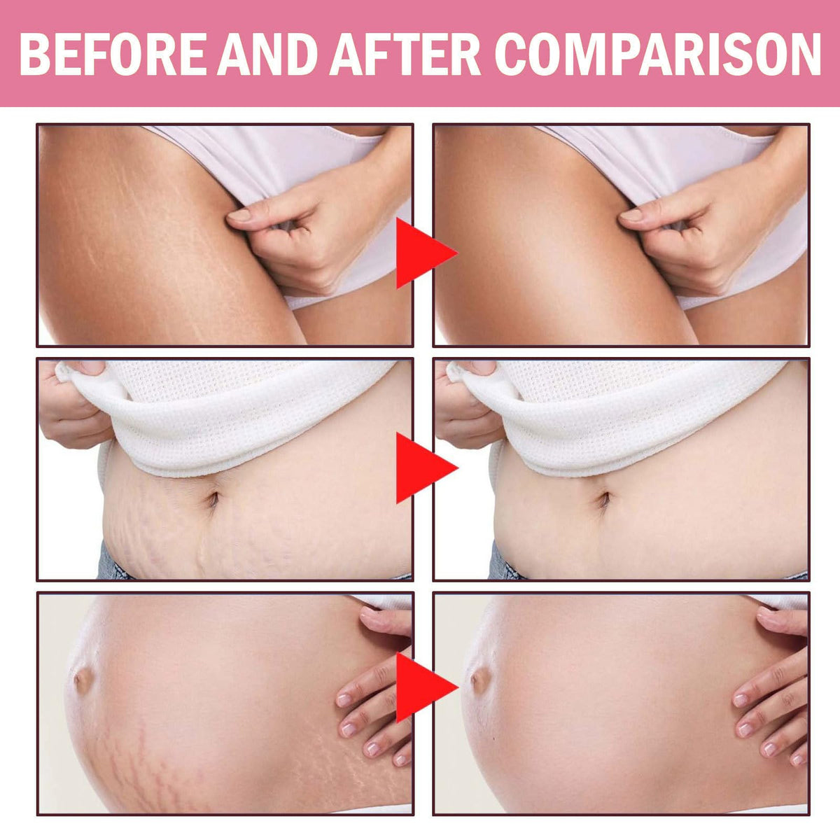 JINMAO being massaged onto abdomen to improve elasticity and tone