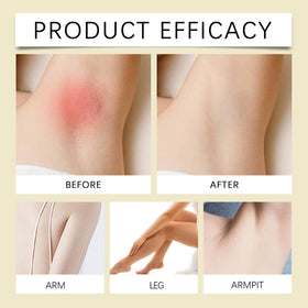 JISKG demonstrating application on face and underarm for soothing benefit