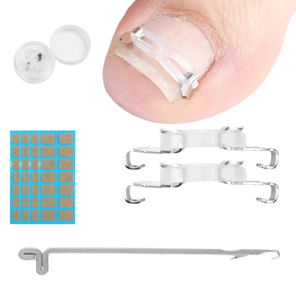 JIUDOUCUO front packaging showing full kit for at-home nail correction