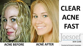 JOESOEF soap lather on skin demonstrating gentle foaming and cleansing benefit