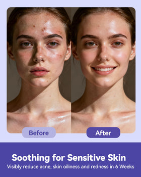 jolly care used on baby skin gentle and hygienic benefit