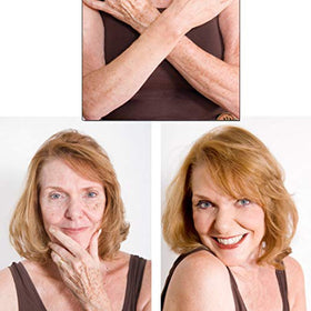 Judith August before and after on arm showing effective camouflage results